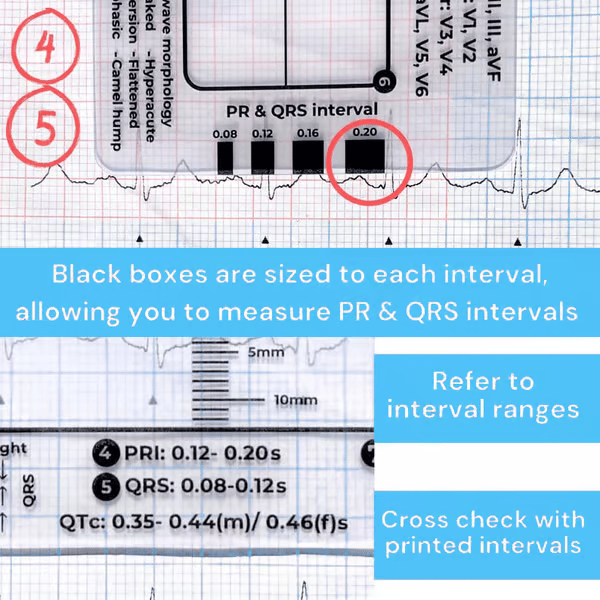 ECG 7 Step Ruler