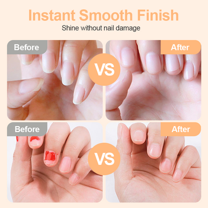 ✂️🎁🔥LAST DAY 49% OFF🔥  -💅 2-in-1 Smart Electric Nail Clipper & Polisher 🌟