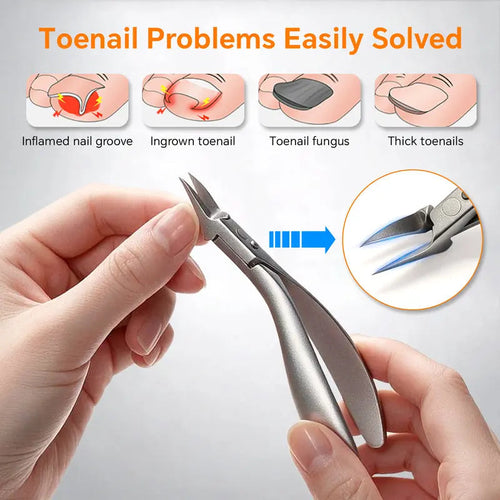 📢📢40% OFF !! ⏰Stainless Steel Ingrown Toenail Clipper and Dead Skin Nipper 2 Piece Manicure Set